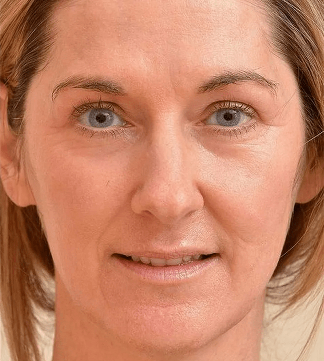 I look younger after I have applied Eudalie -cream